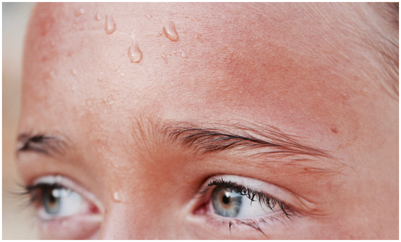 a sweaty woman on one&#39;s forehead