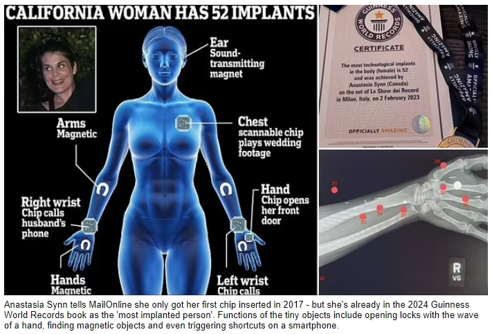 &#39;세계 최고의 싸이보그 여성&#39;...임플란트 기네스 세계 기록 VIDEO: Meet the California woman dubbed the &#39;world&#39;s ultimate CYBORG&#39;