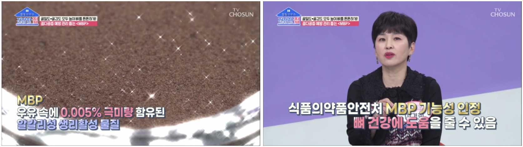 MBP란