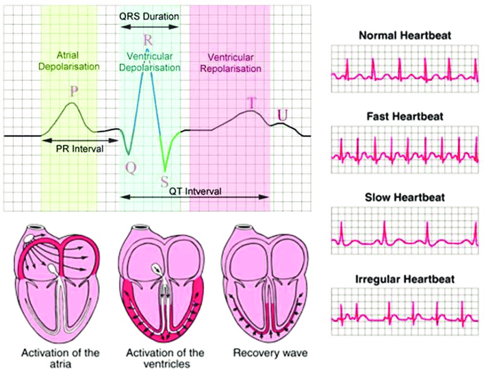  ecg 1 