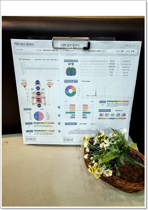 두통이 있을 때 심한 통증이 있다면 군발성 두통입니다. 3
