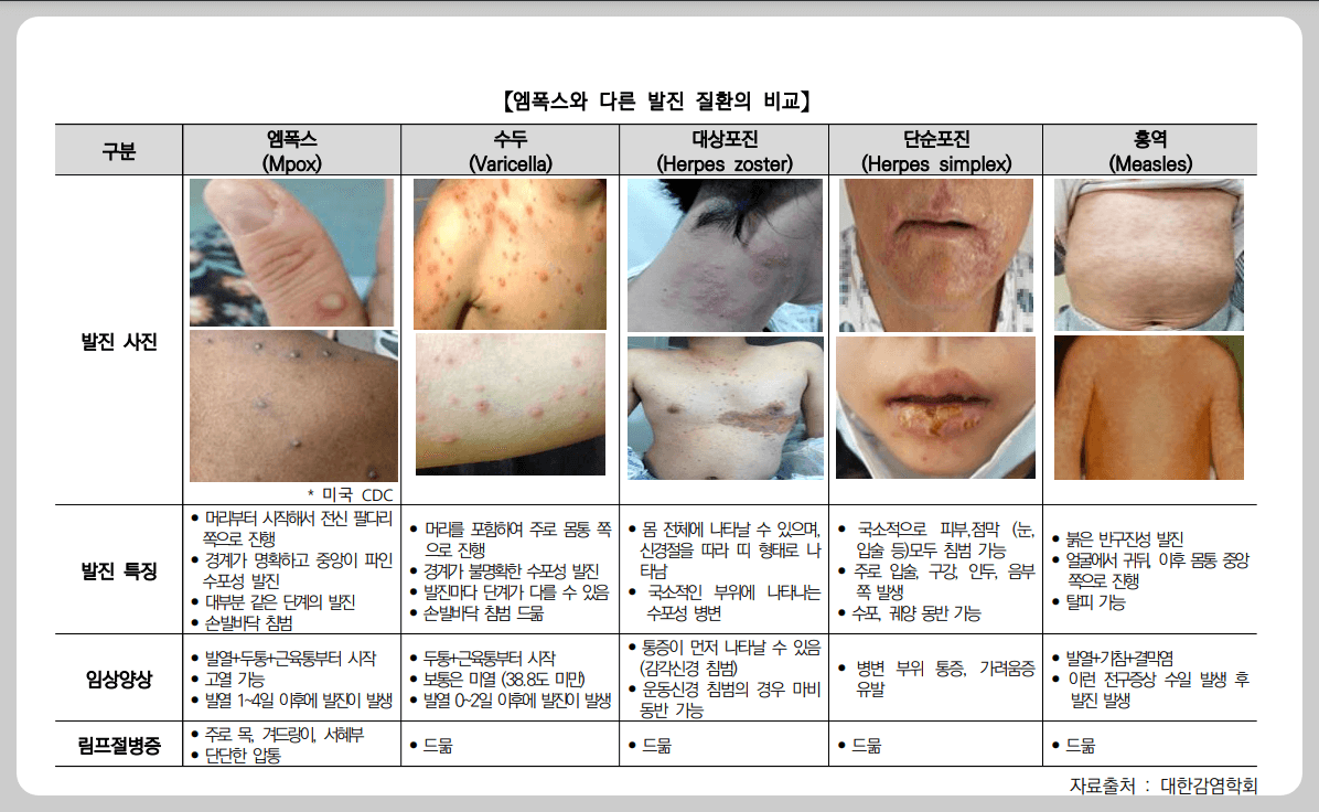 엠폭스 검사방법 예방백신 밀접접촉자 분류기준