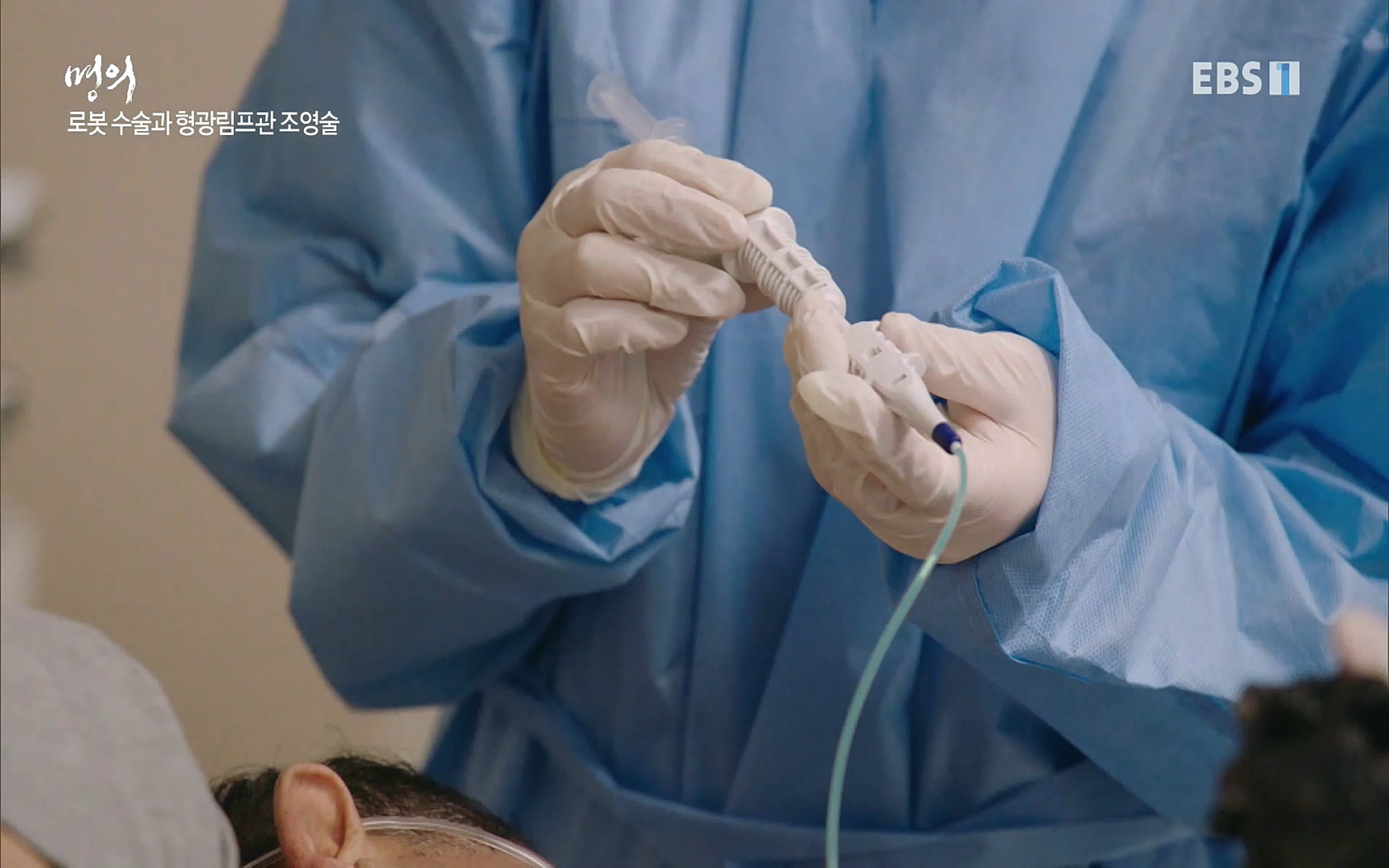 EBS 명의 헬스케어 - TV - 교육의 중심 EBS명의 15년, 위암 치료 이렇게 달라졌다!.mp4_20220809_203714.930.jpg