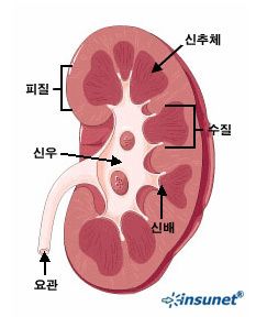 사구체신염 증상