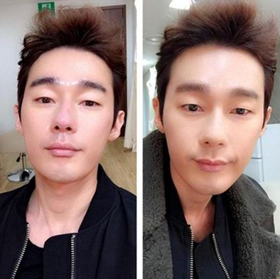  허지웅 과거 이혼사유와 보톡스 부작용 논란