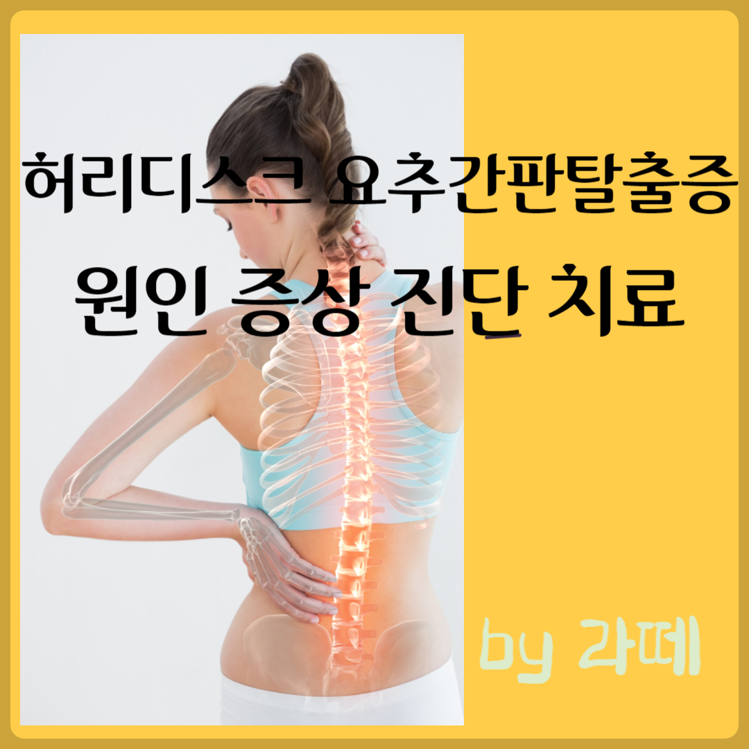 허리디스크 요추간판탈출증 원인&#44; 증상&#44; 진단방법&#44; 치료법