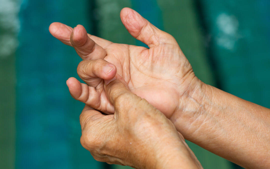  손가락이 붓는 원인들  Reasons Why Your Fingers Are Swollen