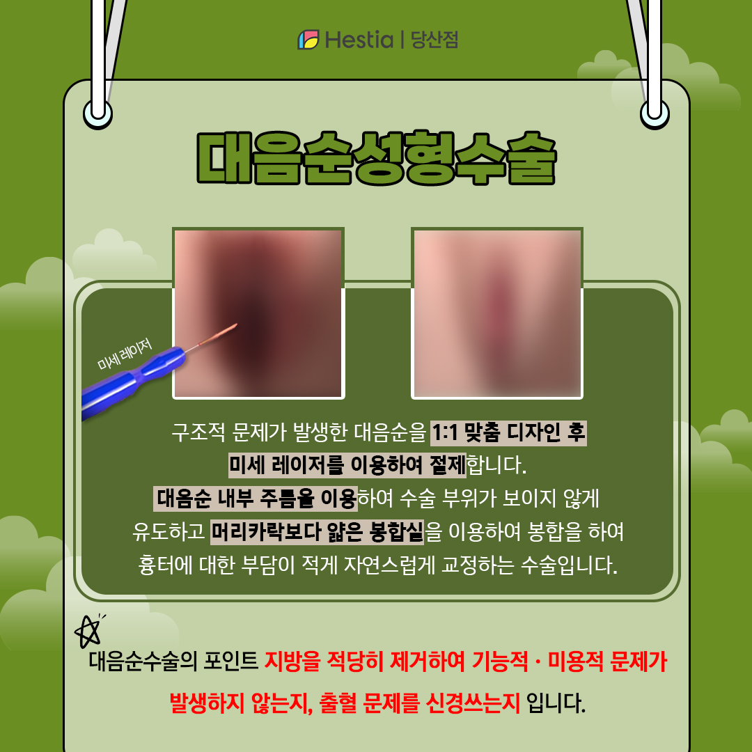 대음순성형수술이란?