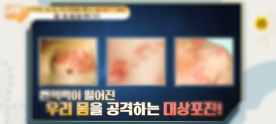  (내몸사용설명서)대상포진에서벗어날비법 하루3분면역력충전방법양생법 면역력자가진단법 334회 면역력신호놓치면사망에이른다 대상포진주의보0101