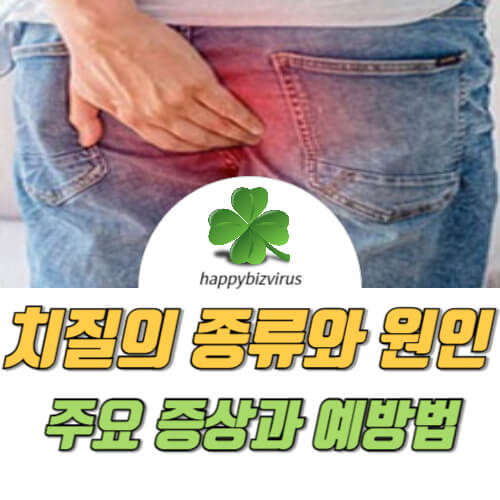 치질의 종류와 원인 썸네일 이미지