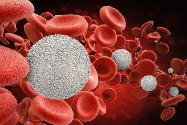 Eosinophil 수치
