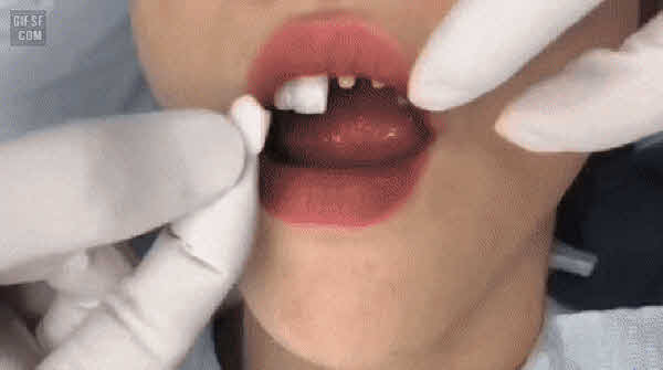  요즘 여자들 많이하는건대 나중에 엄청 후회하는 성.형.수.술