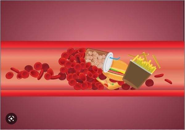 ldl-cholesterol