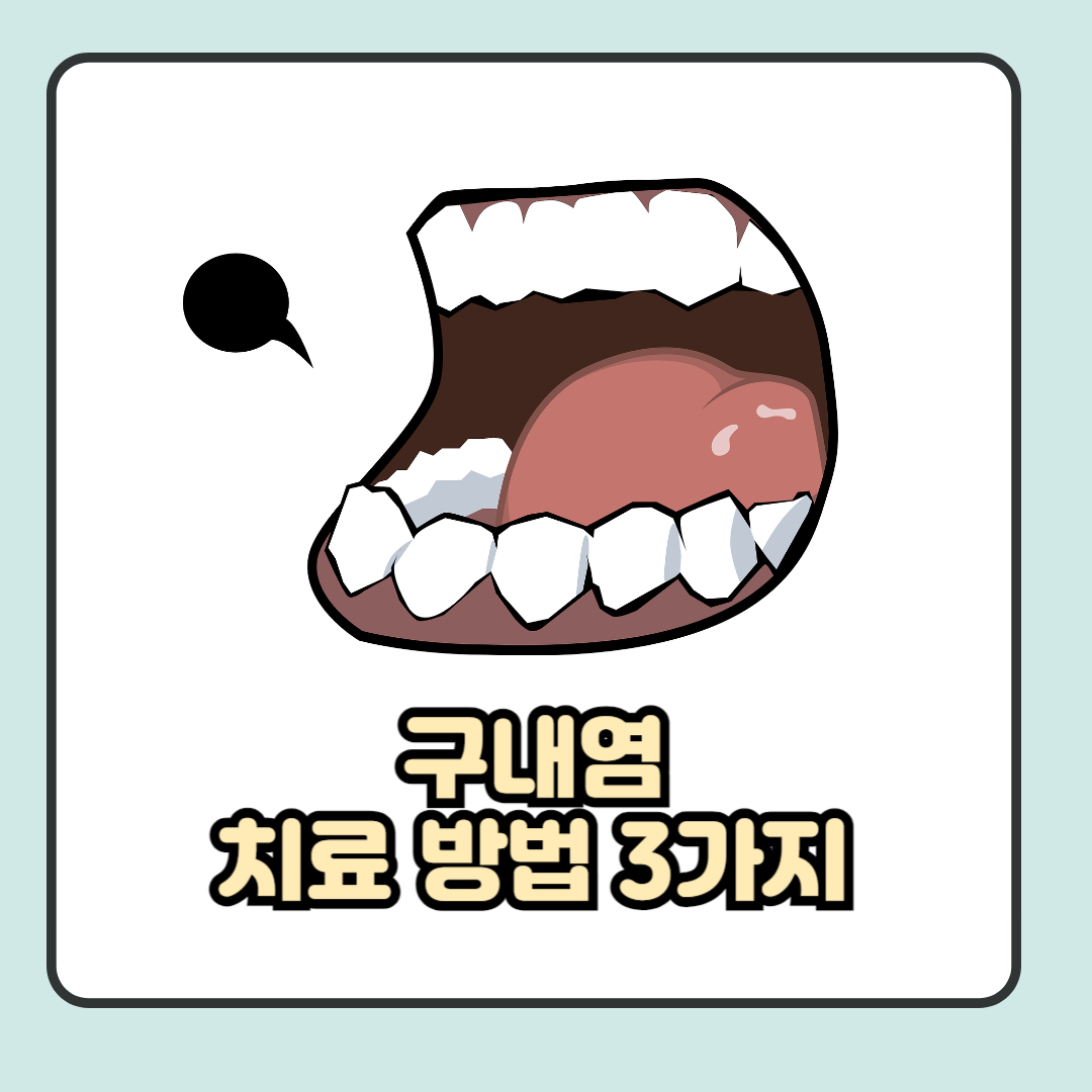 구내염 치료 방법 3가지