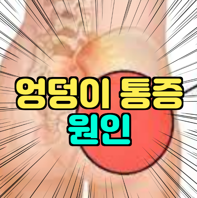  엉덩이 통증 원인 개선방법!