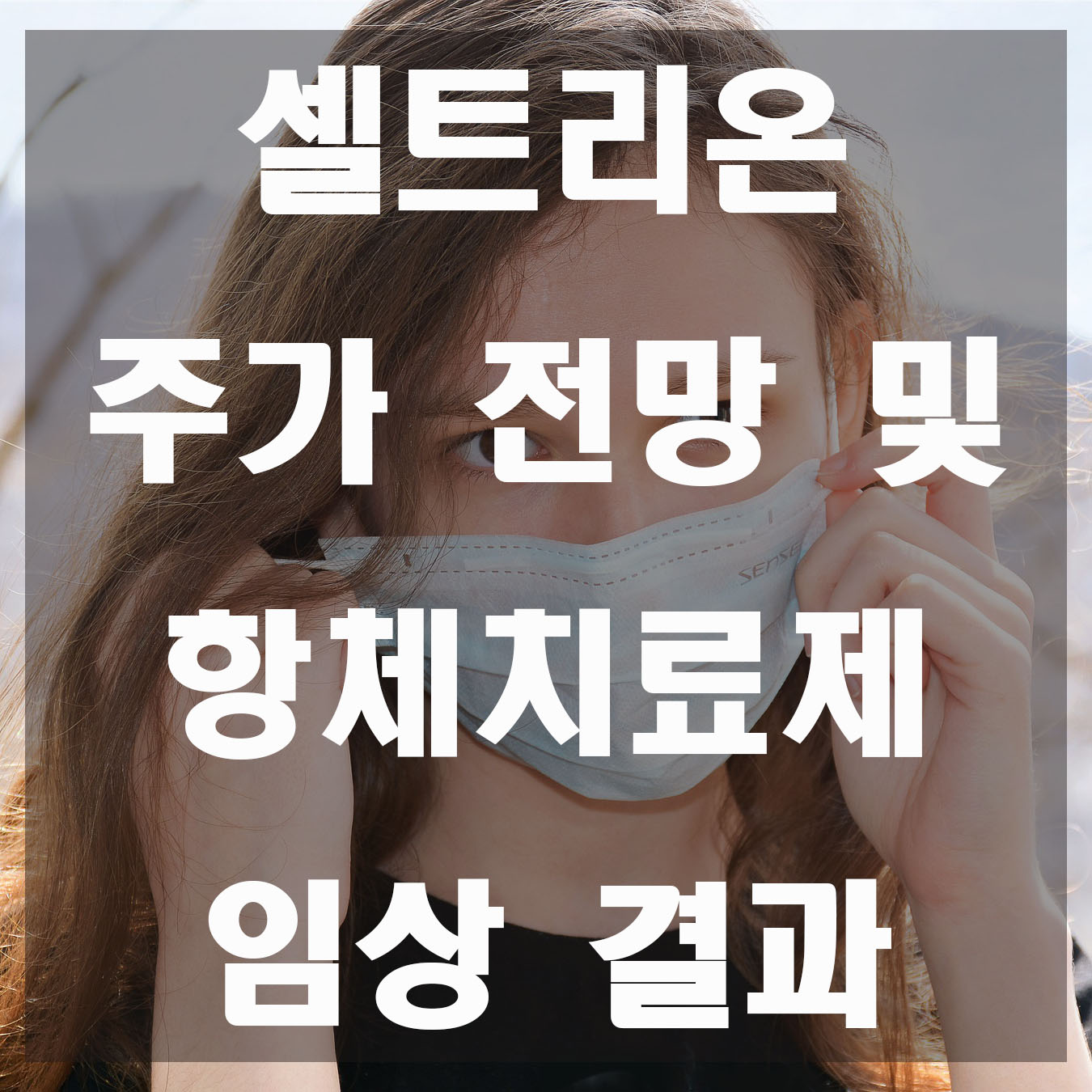  셀트리온 주가 전망 및 항체치료제 임상 2상 결과