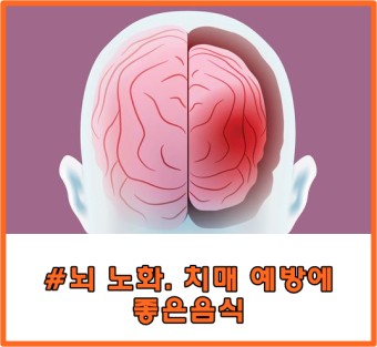 뇌노화 현상