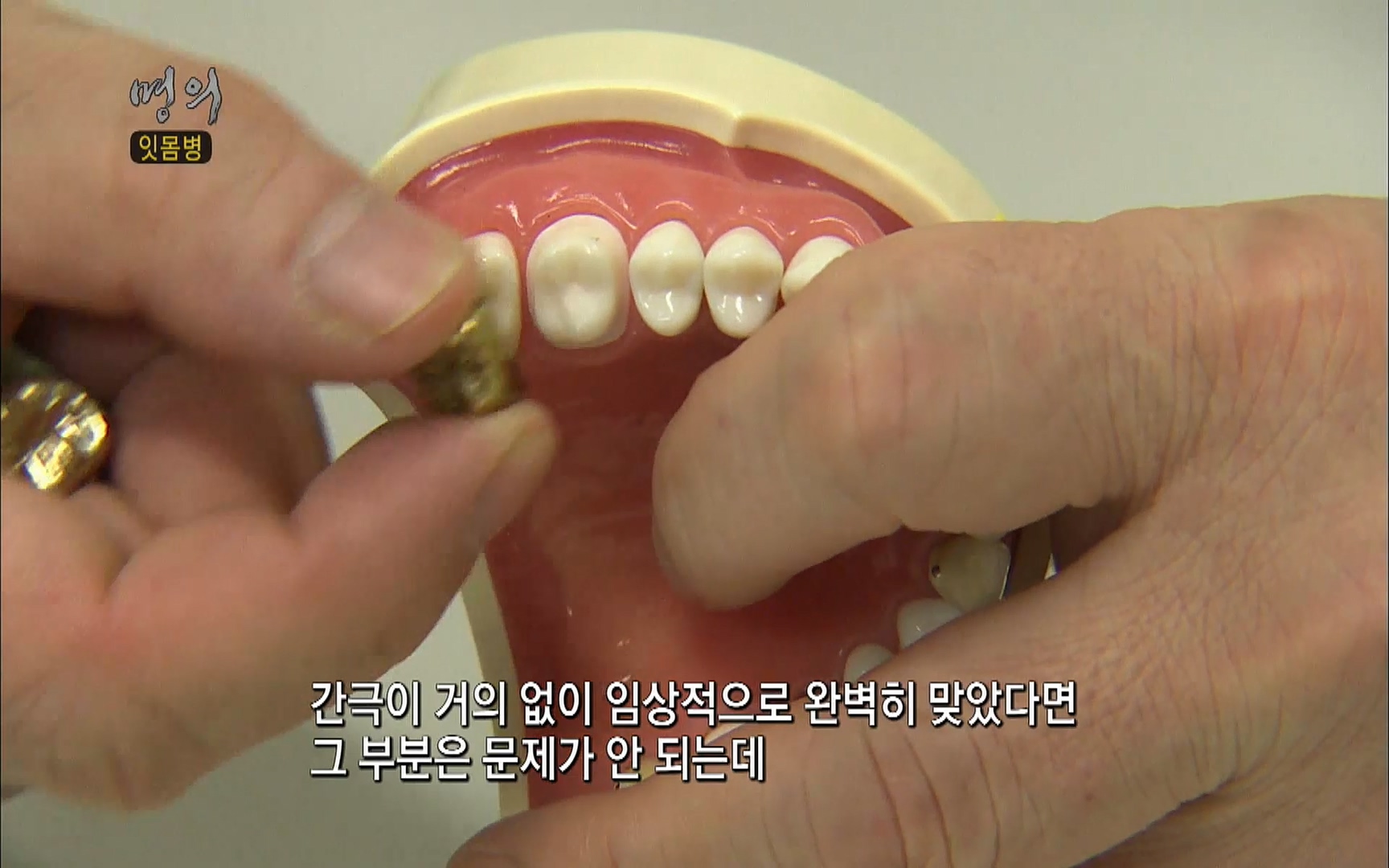 EBS 명의 헬스케어 - TV - 교육의 중심 EBS2015년 1월 16일 (금) 밤 9시 50분, EBS1.mp4_20220505_145636.224.jpg