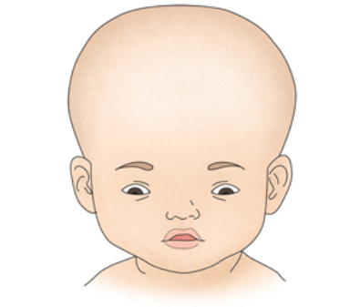  수두 증상/예방접종/원인/치료방법