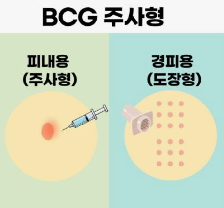 결핵예방접종