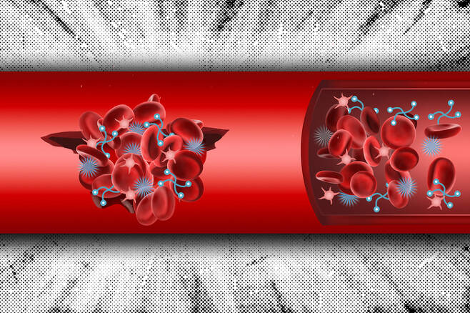 미국 매사추세츠공대(MIT) 연구진이 개발한 인공 물질이 혈액 속의 혈소판을 다량으로 끌어당겨 서로 엉기게 만드는 방법으로 내출혈을 막는 모습을 묘사한 개념도. 빨간색 원반형 물체가 혈소판&#44; 파란색 밤송이와 끈처럼 생긴 물체가 연구진이 만든 인공 물질이다.
