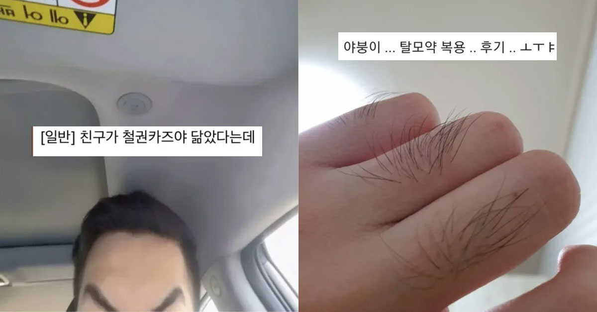  눈물없이 볼 수 없는 탈모갤 인증글들 ㅠㅠ