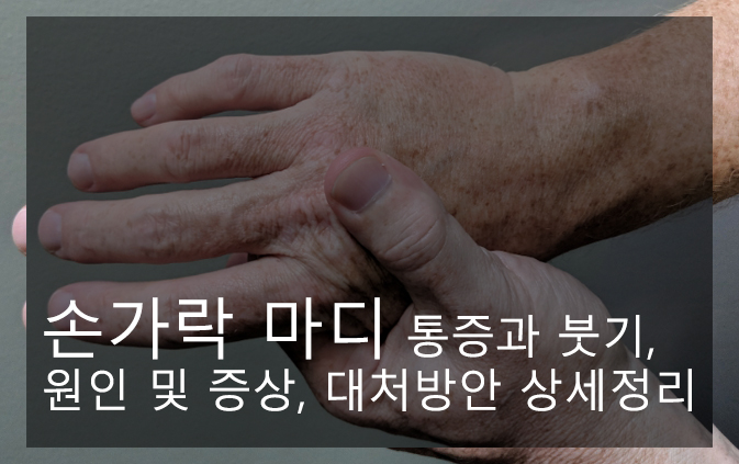 손가락 마디 통증과 붓기, 원인 및 증상, 대처방안 상세정리
