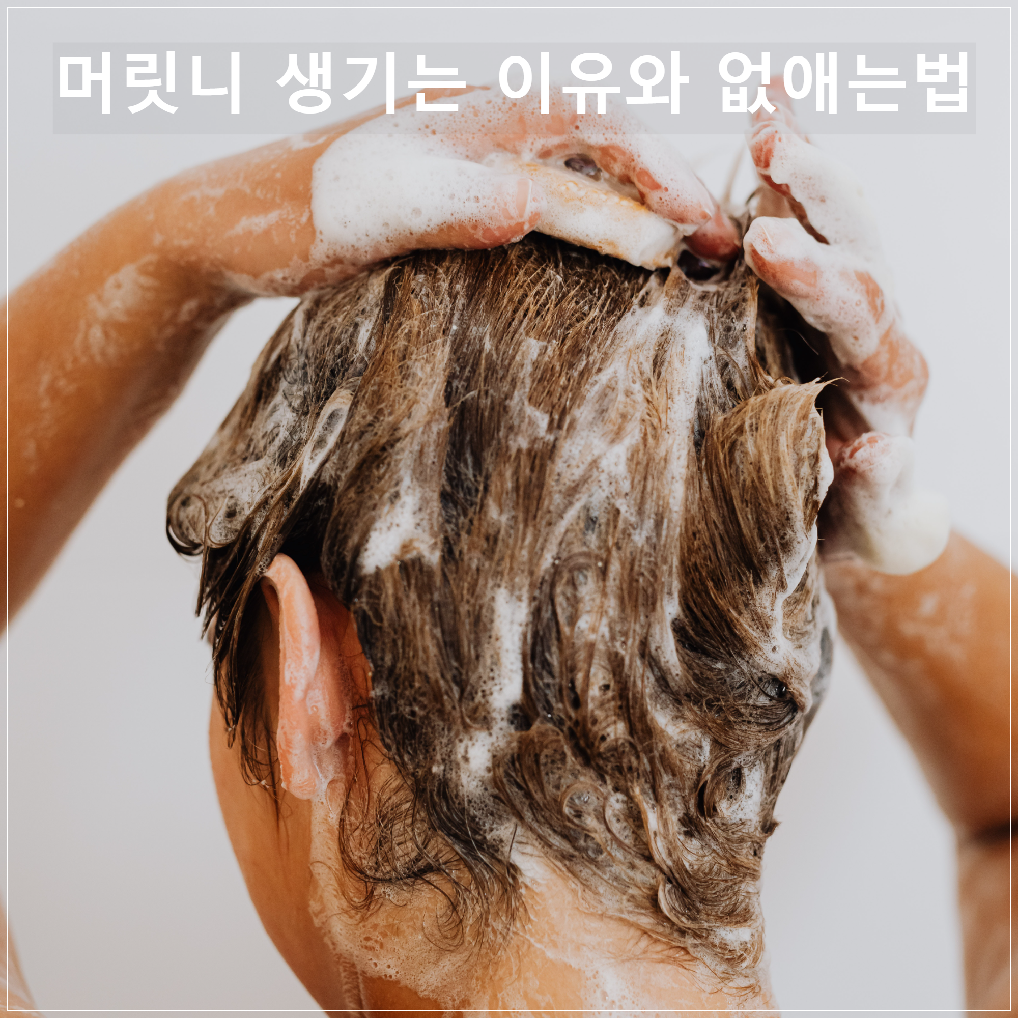 머릿니 제거