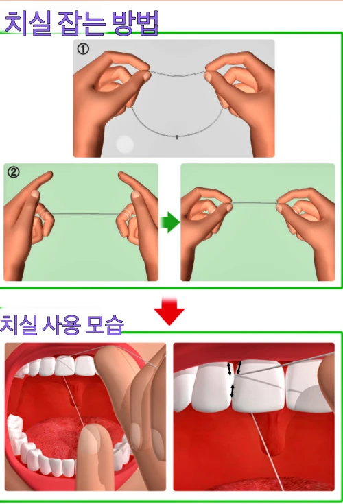 올바른 치실 사용법에 대해서 설명하는 이미지