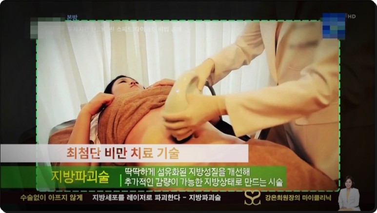 셀룰라이트 제거까지 지방파괴술 효과, 뱃살 다이어트부터 복부 8