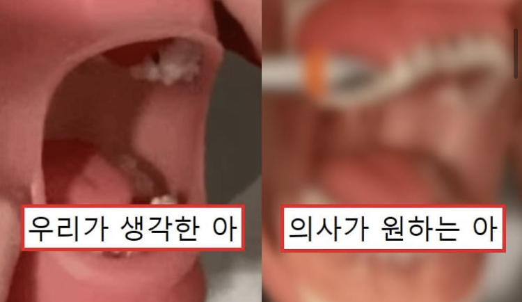  치과에서 의사가 원하는 입 벌리기