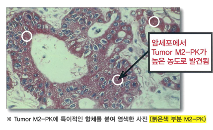 M2PK검사원리