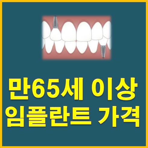  65세 이상 임플란트 가격 부담 낮추기
