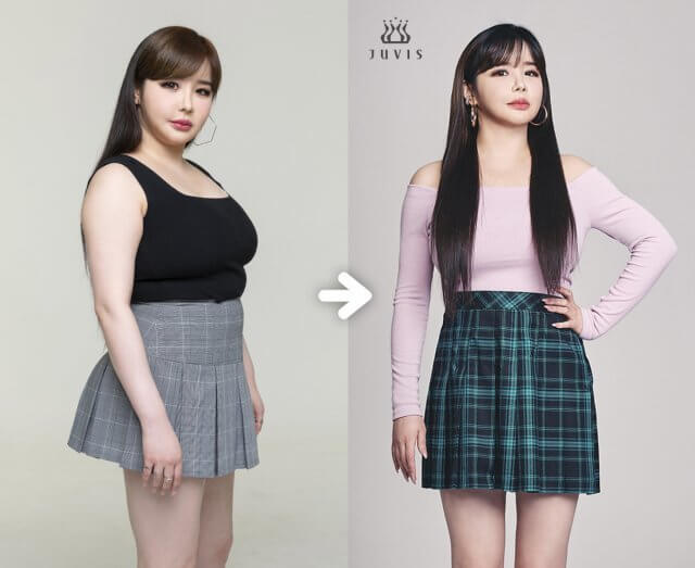 박봄 다이어트