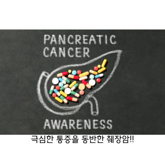  췌장암 치료가 어렵고 통증이 심한 암