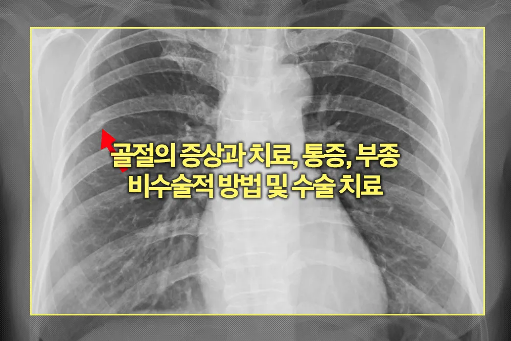 골절, 골절 치료, 골절 증상