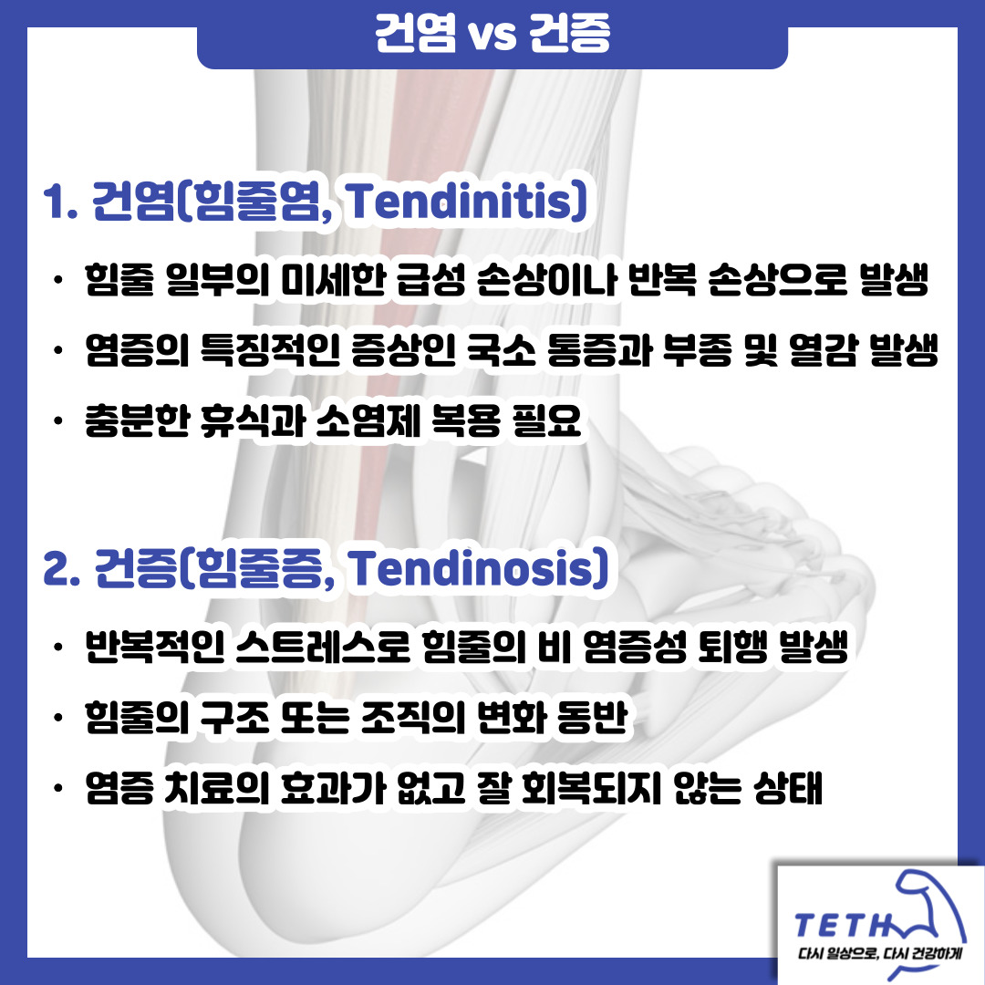 건염과 건증(2)