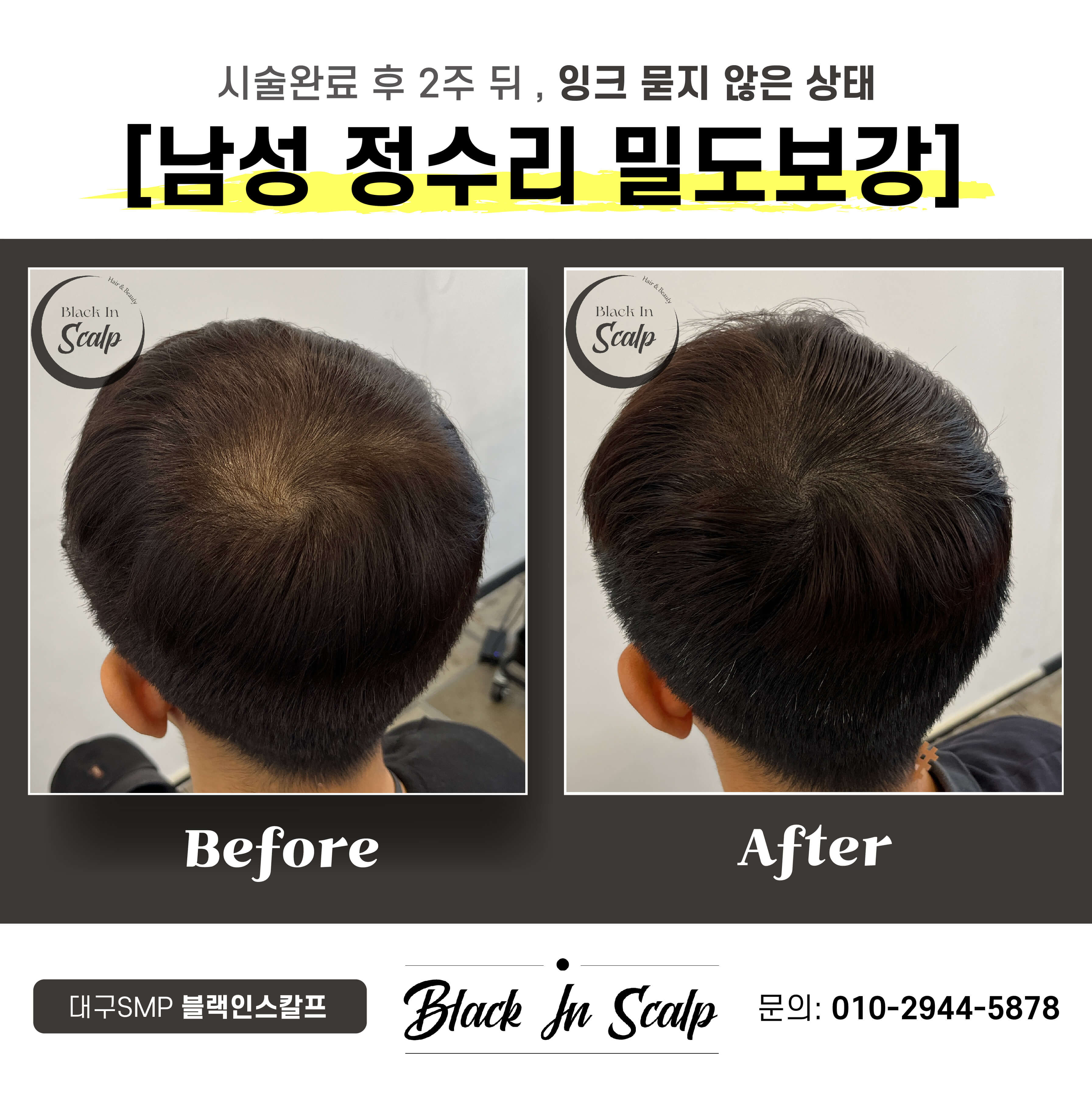 준호헤어라인 이미지