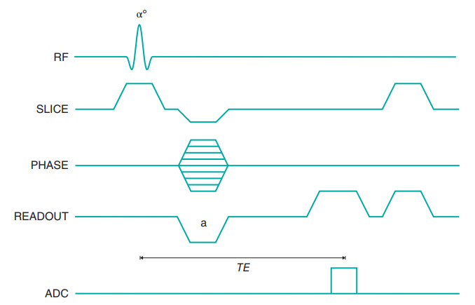 spoiled gradient echo 시퀀스의 타이밍 다이어그램