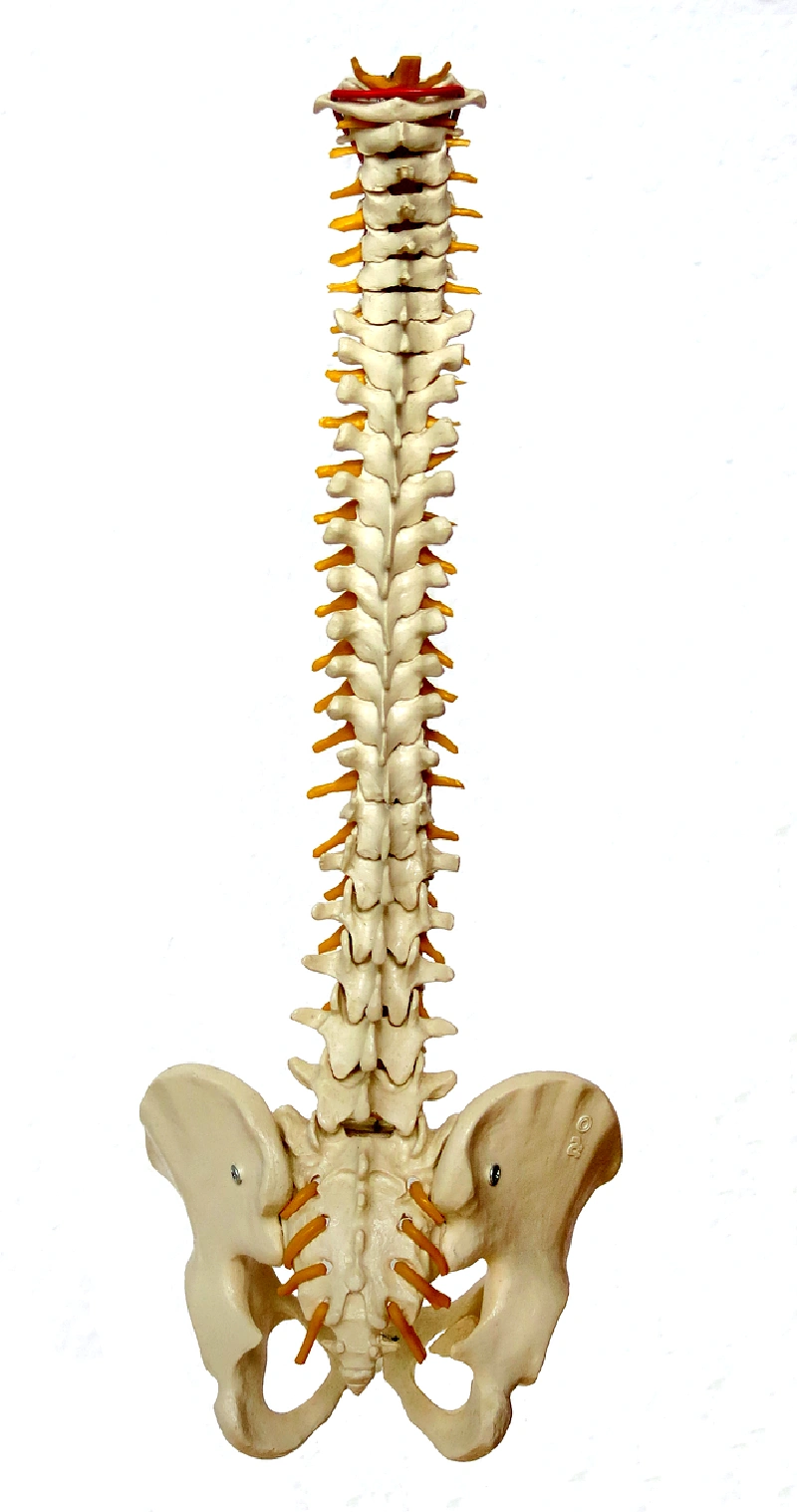 척추분쇄압박골절-원인-골다공증
