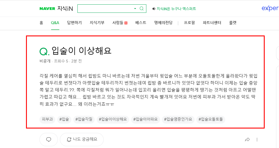 입술 트러블 질문