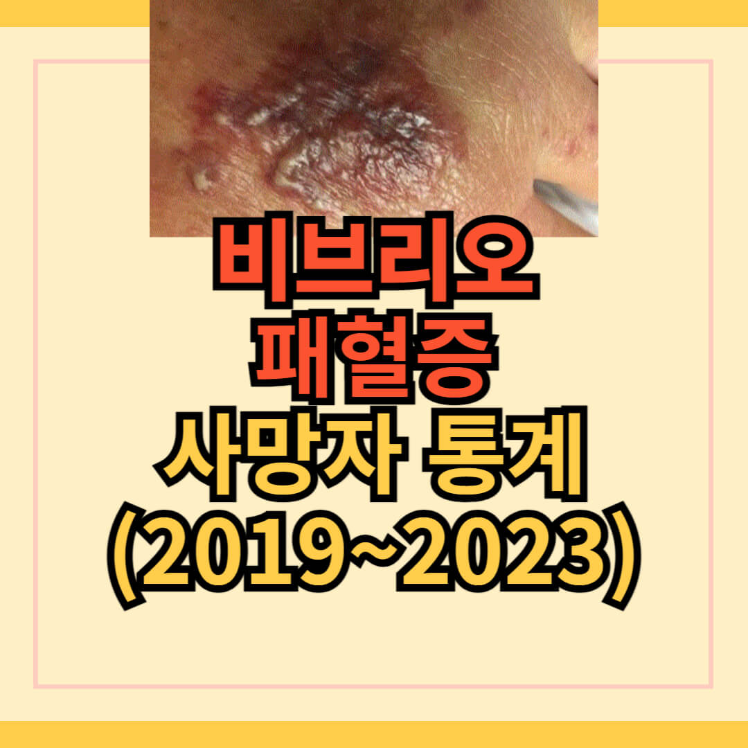 비브리오 패혈증 사망자 통계(2019~2023)