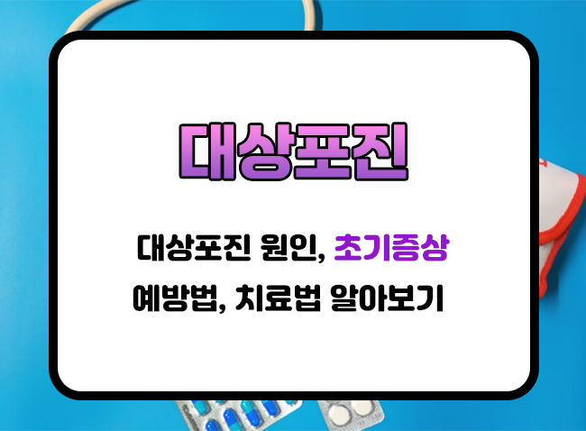  대상포진 초기증상 확인하기