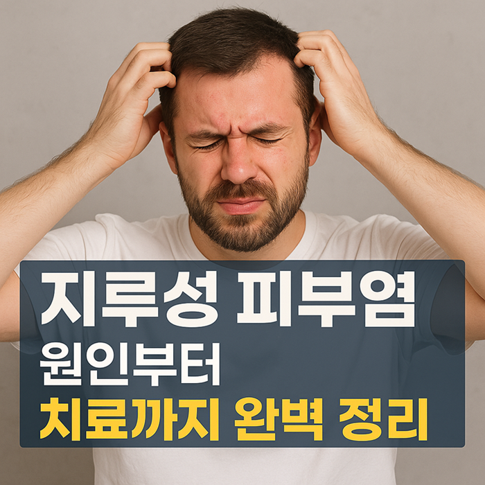지루성 피부염 원인부터 치료까지 완벽정리