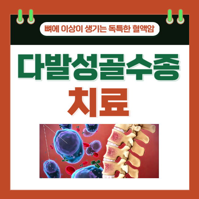  뼈에 이상이 생기는 독특한 혈액암. 다발성 골수종의 치료