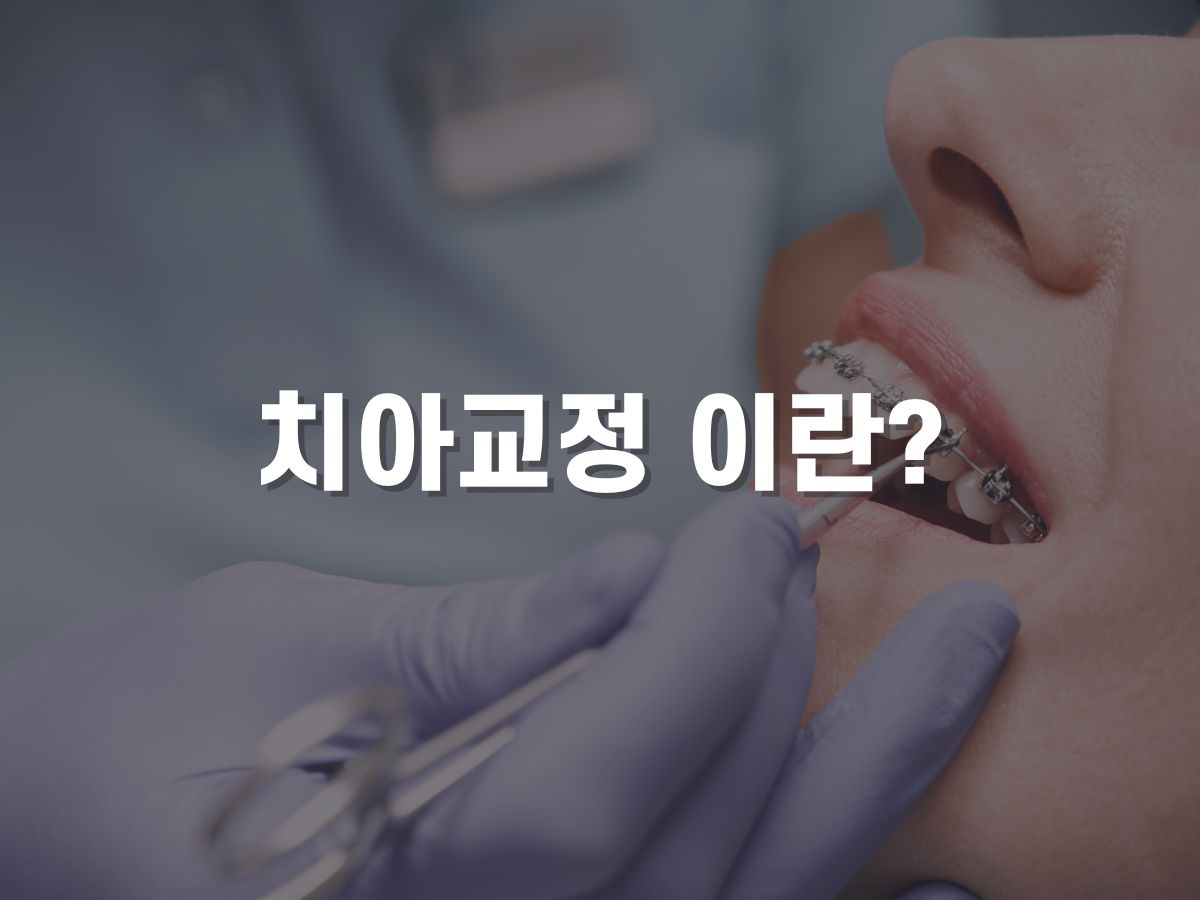 치아교정 이란