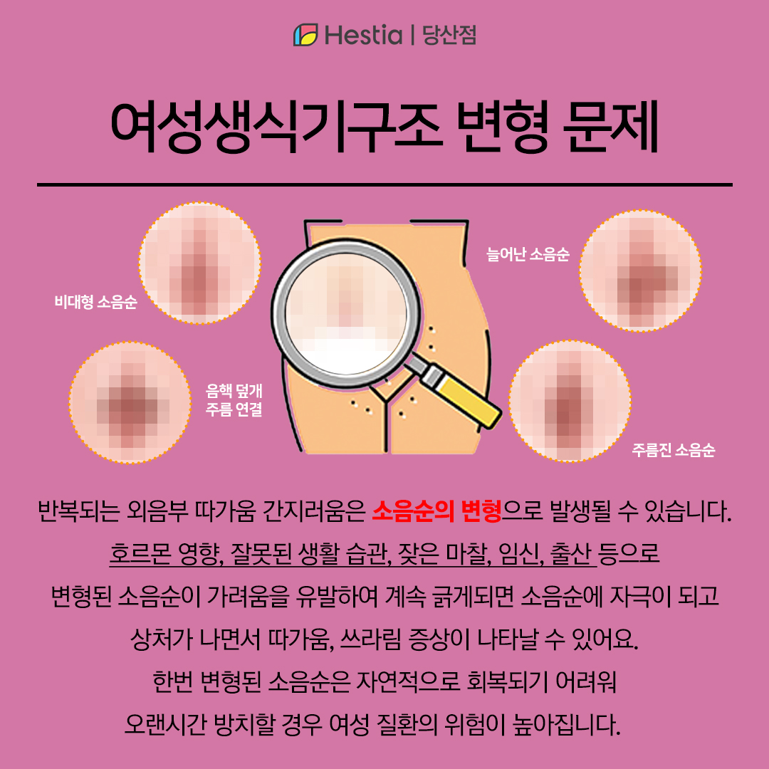 여성생식기구조 변형의 문제는?