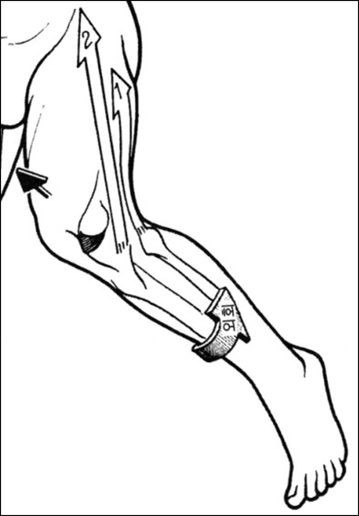 경골을 외회전 시키는 근육을 나타낸 그림