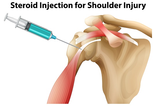 shoulder-surgery