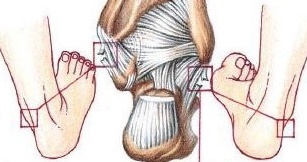  염좌 증상 및 원인 응급 처치, 치료 방법 알아봤습니다.